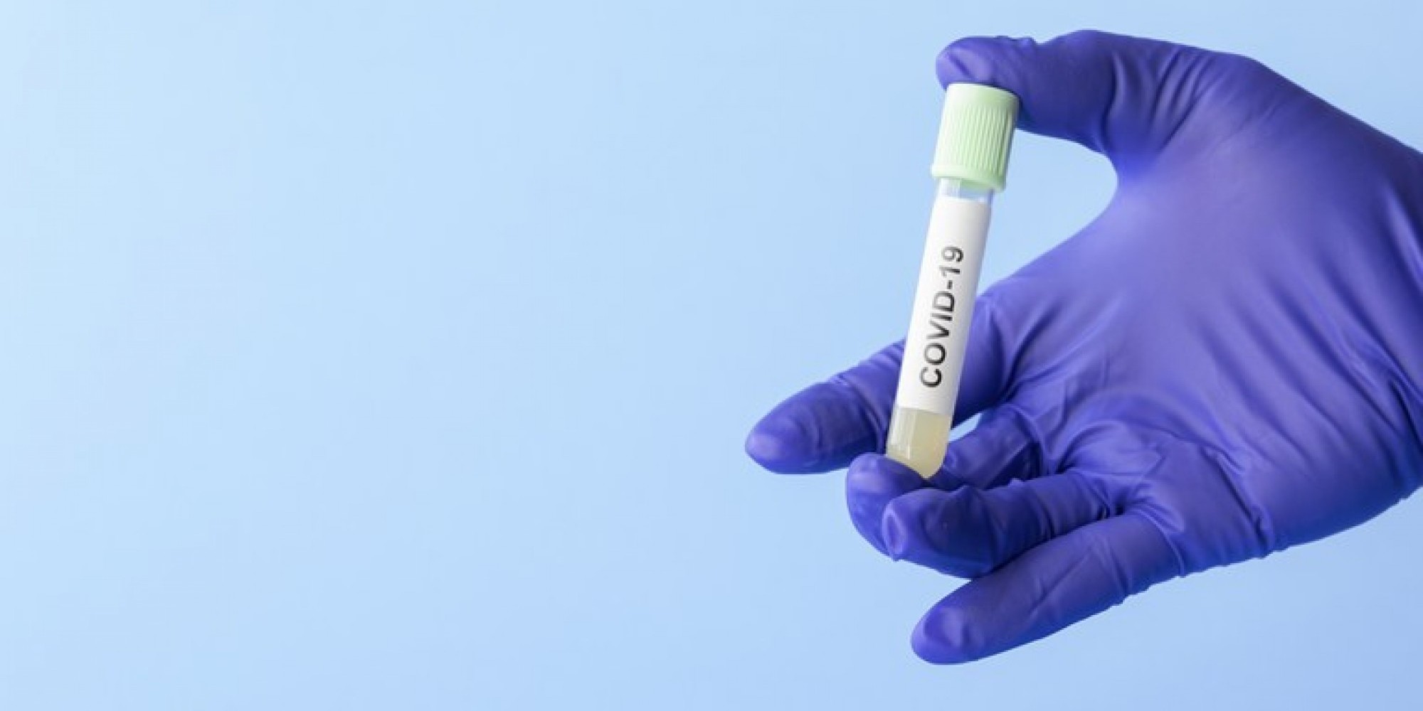 Atualmente, o Brasil faz 13,7 testes a cada mil habitantes