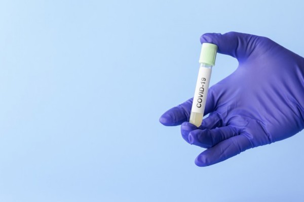 Atualmente, o Brasil faz 13,7 testes a cada mil habitantes