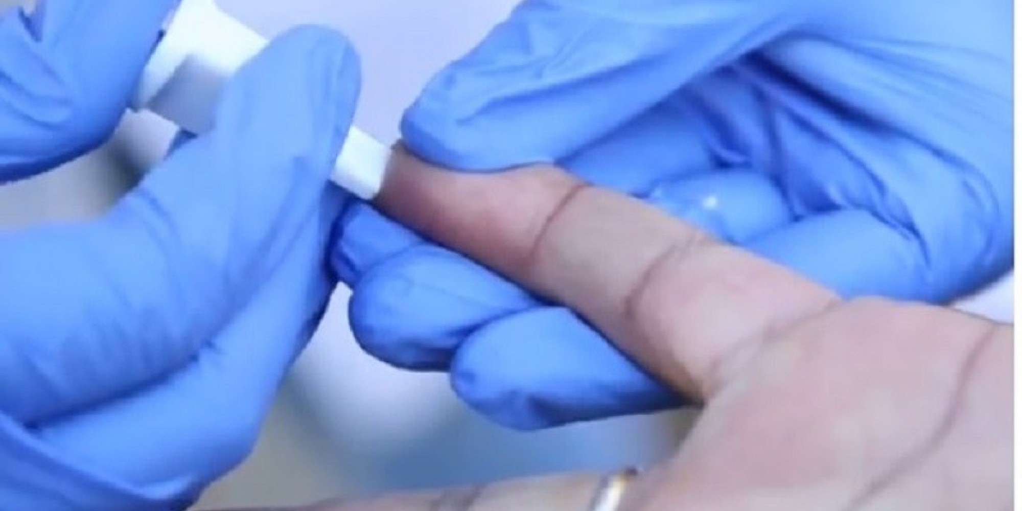 Basta a coleta de uma gota de sangue e o resultado é processado em 15 minutos