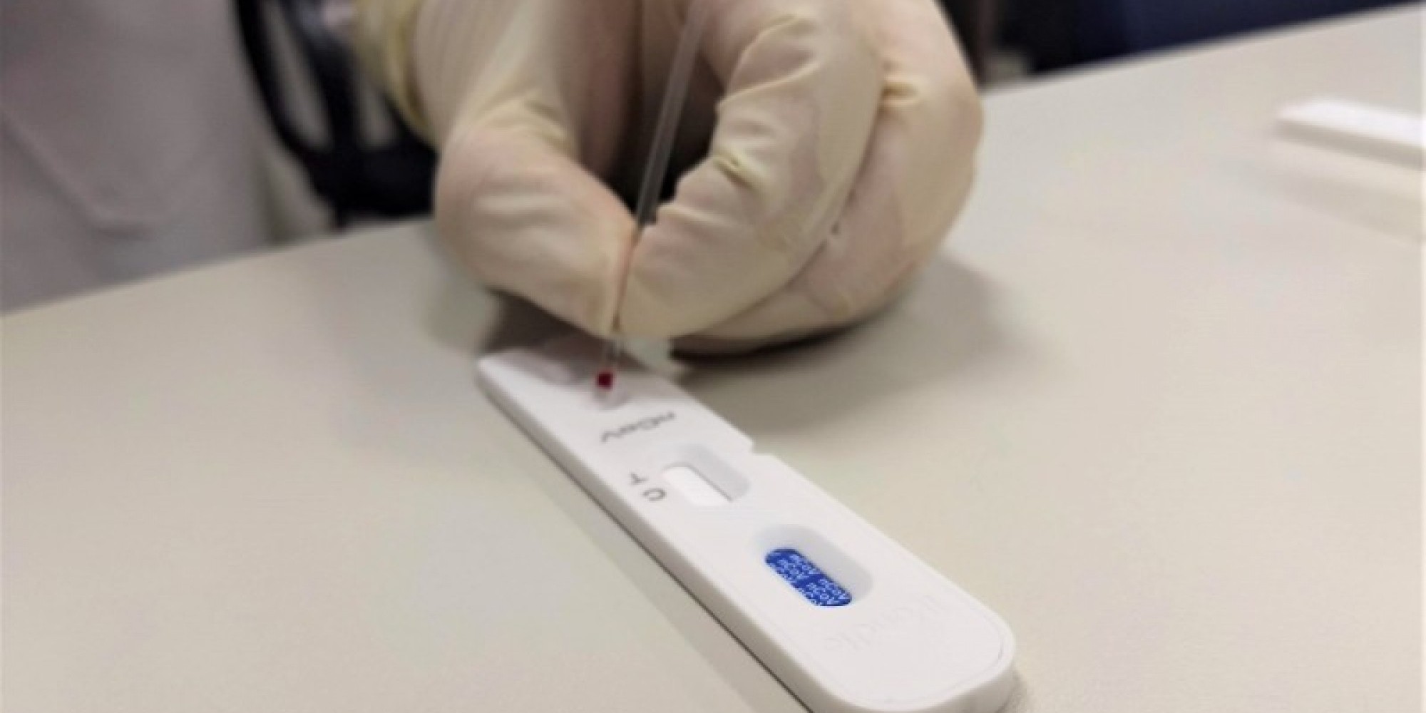  Exame fornece resultado em 15 minutos