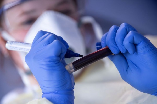 Nova variante já colocou em alerta outros países 