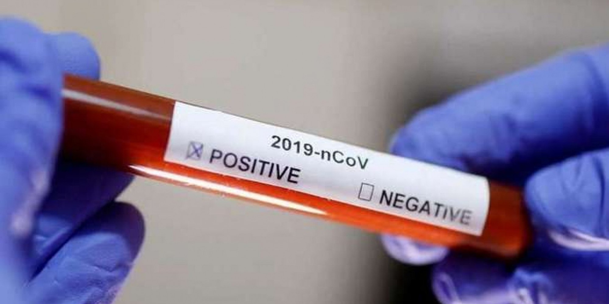 Novos casos foram confirmados neste sábado