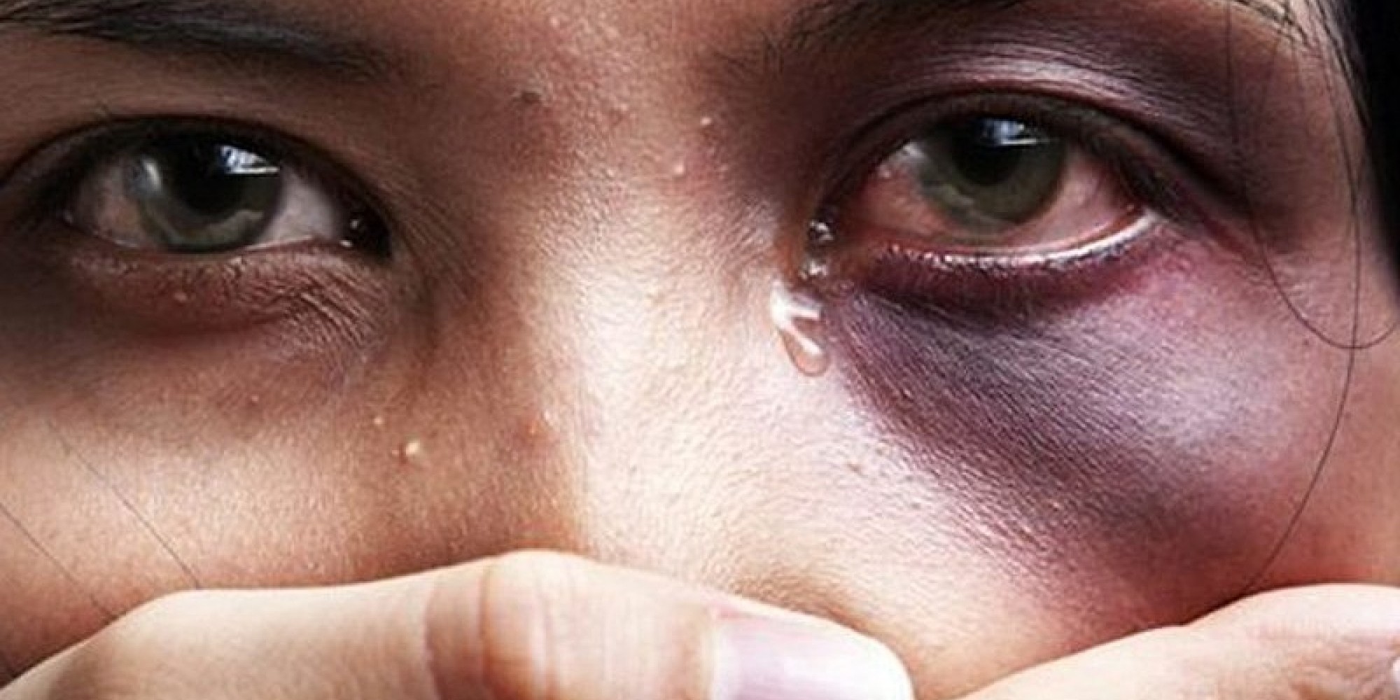 Mulher grávida sofre agressão com facão e enxada
