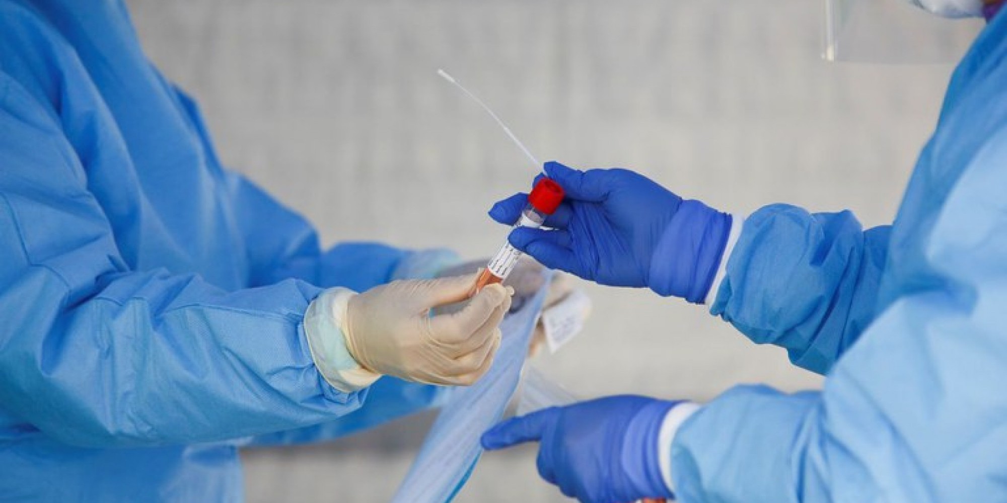 A testagem rápida pode apresentar o resultado em um minuto