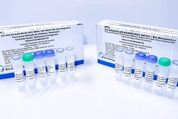 Anvisa autoriza o uso emergencial de kits para diagnóstico da Monkeypox