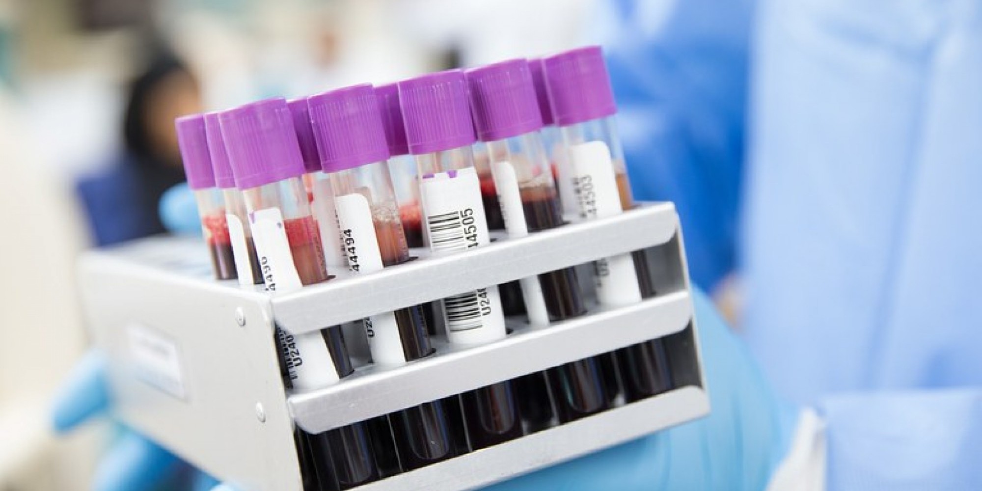 Previsão do governo é que a produção da vacina no Brasil tenha início a partir de dezembro deste ano 