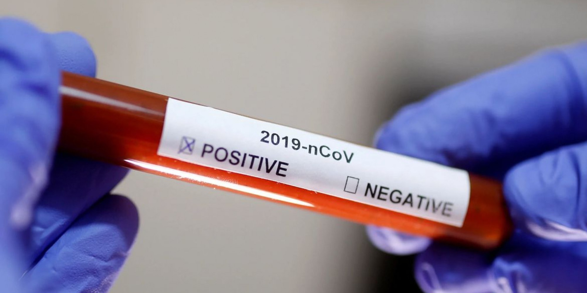 Resultados foram divulgados neste sábado