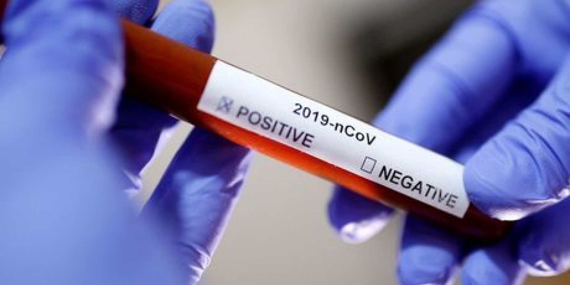 Homem era morador de Encantado