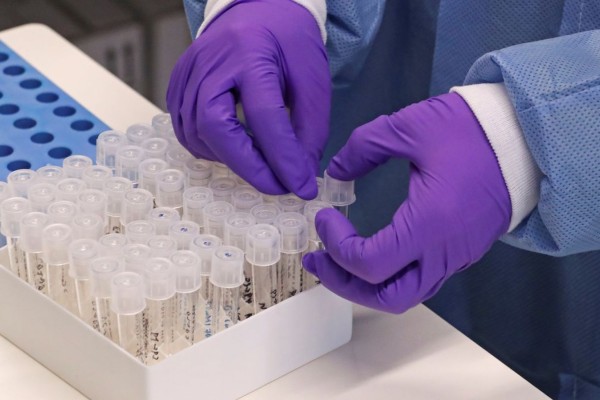 Encantadense morre por Covid-19 