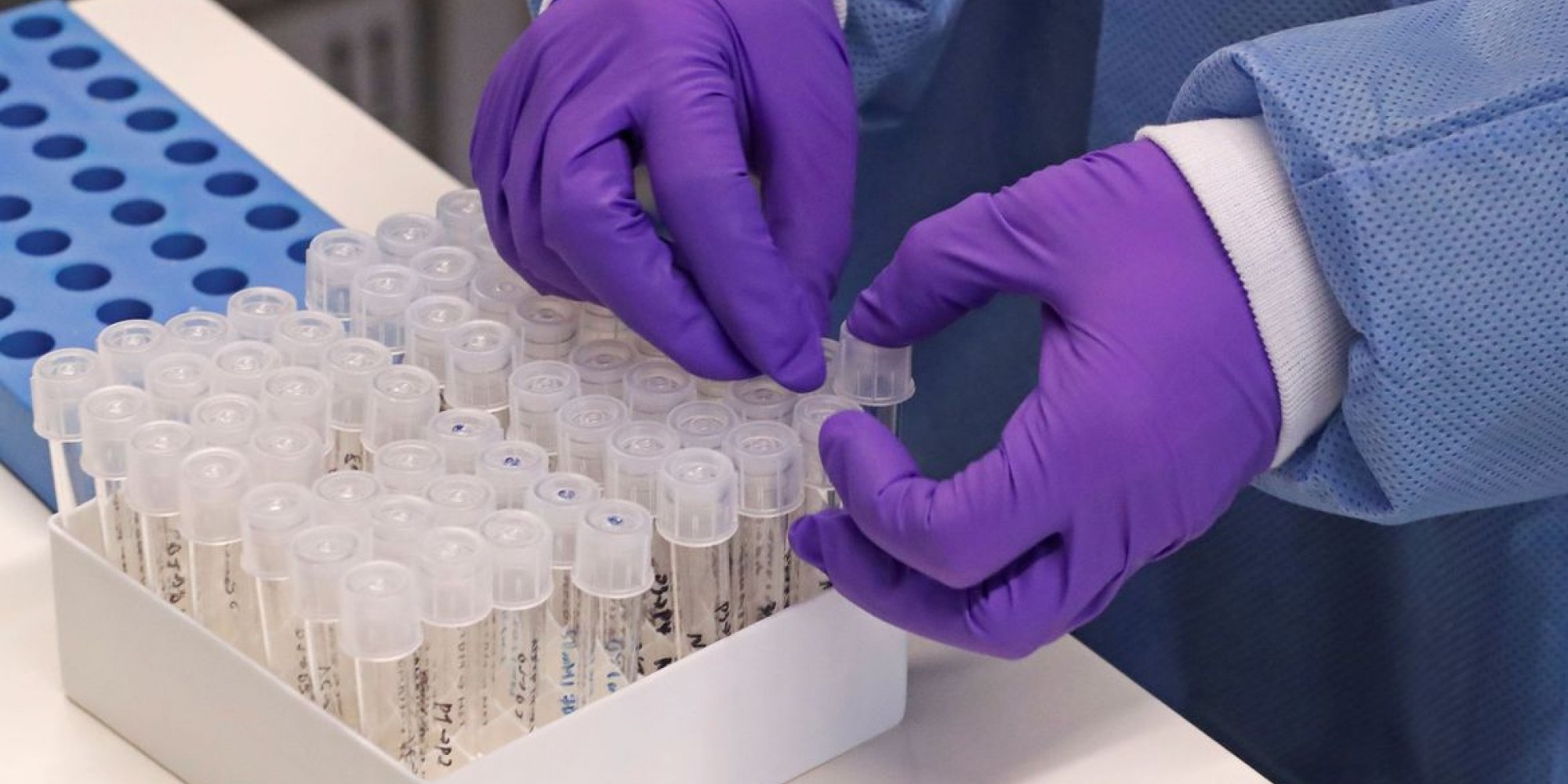  Estratégia da SES a partir de agora é enviar os relatórios das aplicações de doses apontadas como inconsistente