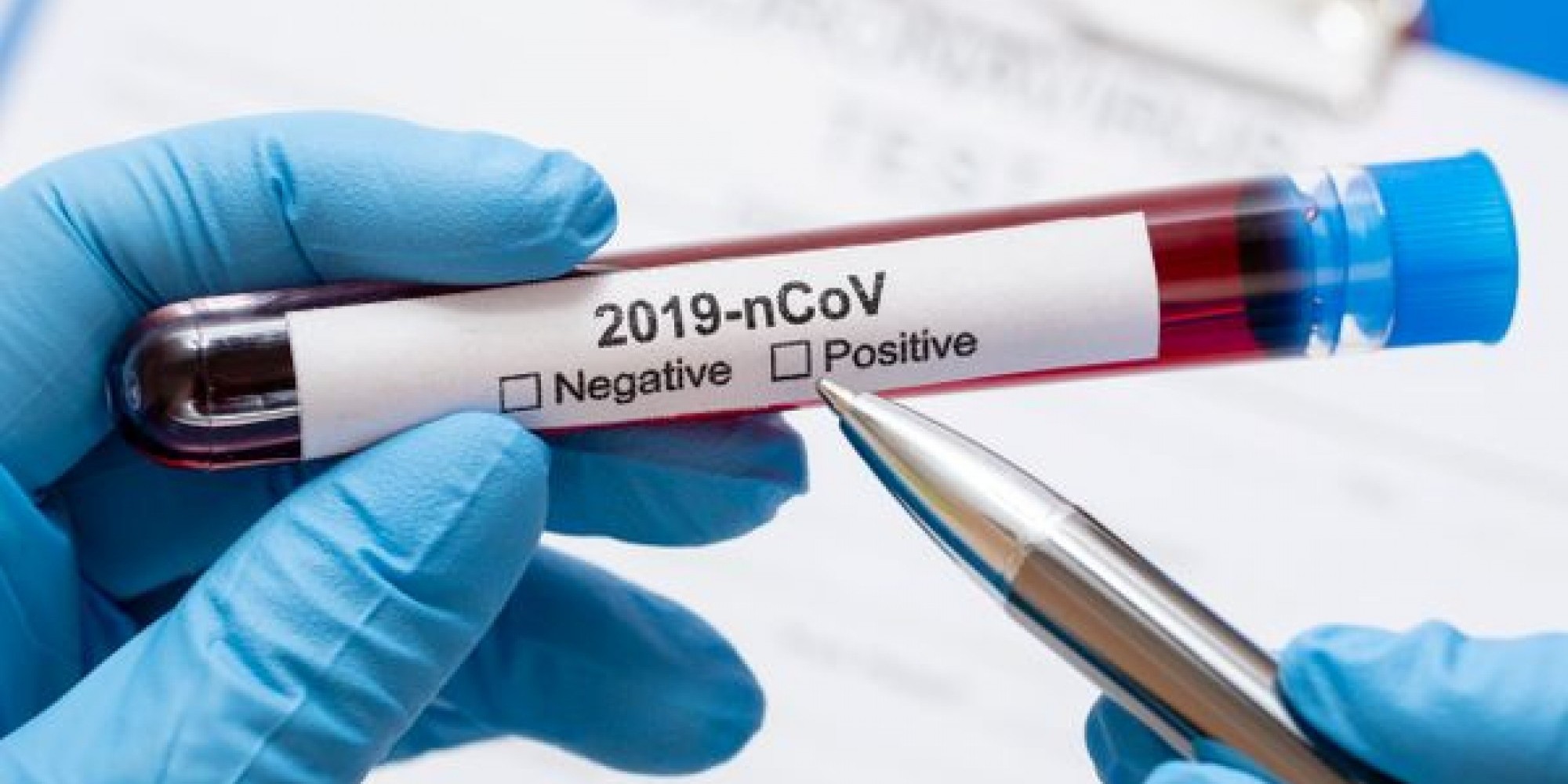 Testes serão destinados aos hospitais gaúchos  