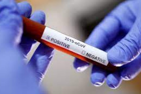 Encantado ultrapassa 2,2 mil casos de Covid-19 