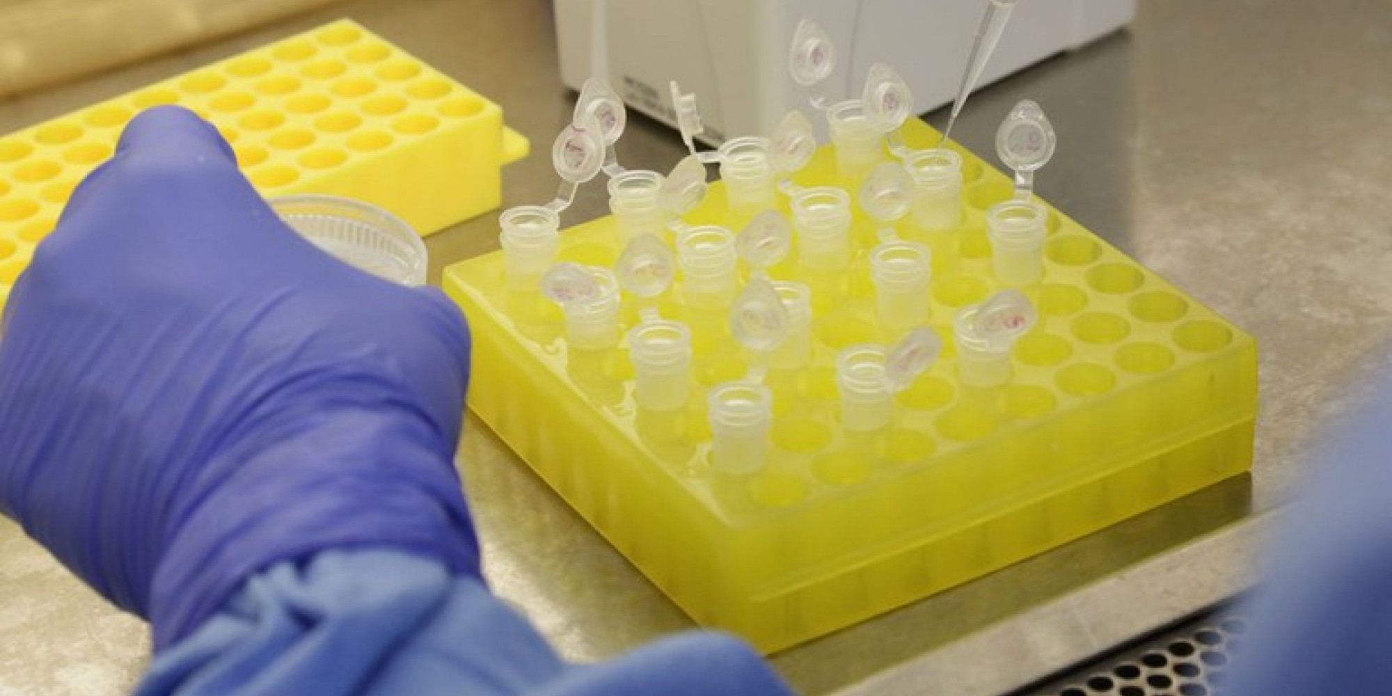 Dos 11 testes aprovados até o momento no Brasil, nove são do tipo rápido, com resultados em cerca de 15 minutos, e dois são do tipo molecular