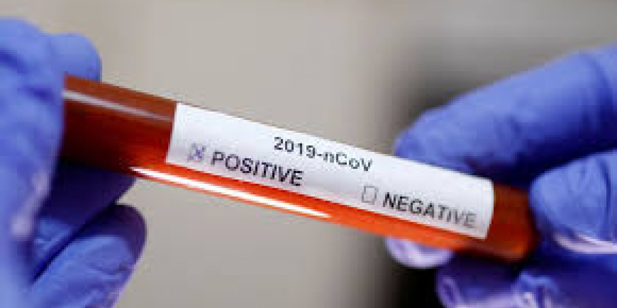 Até agora são 56 infectados 