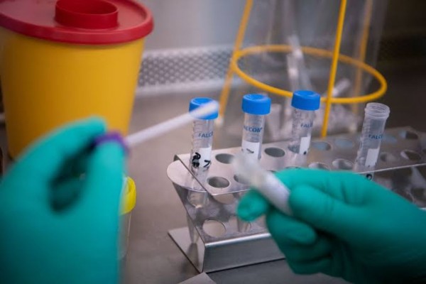 Plano foi elaborado pelo Centro de Operações de Emergências (COE) da SES