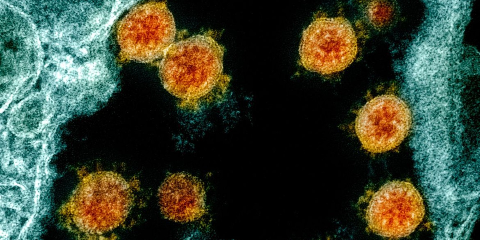 As vítimas eram residentes dos municípios de Sapiranga e Progresso