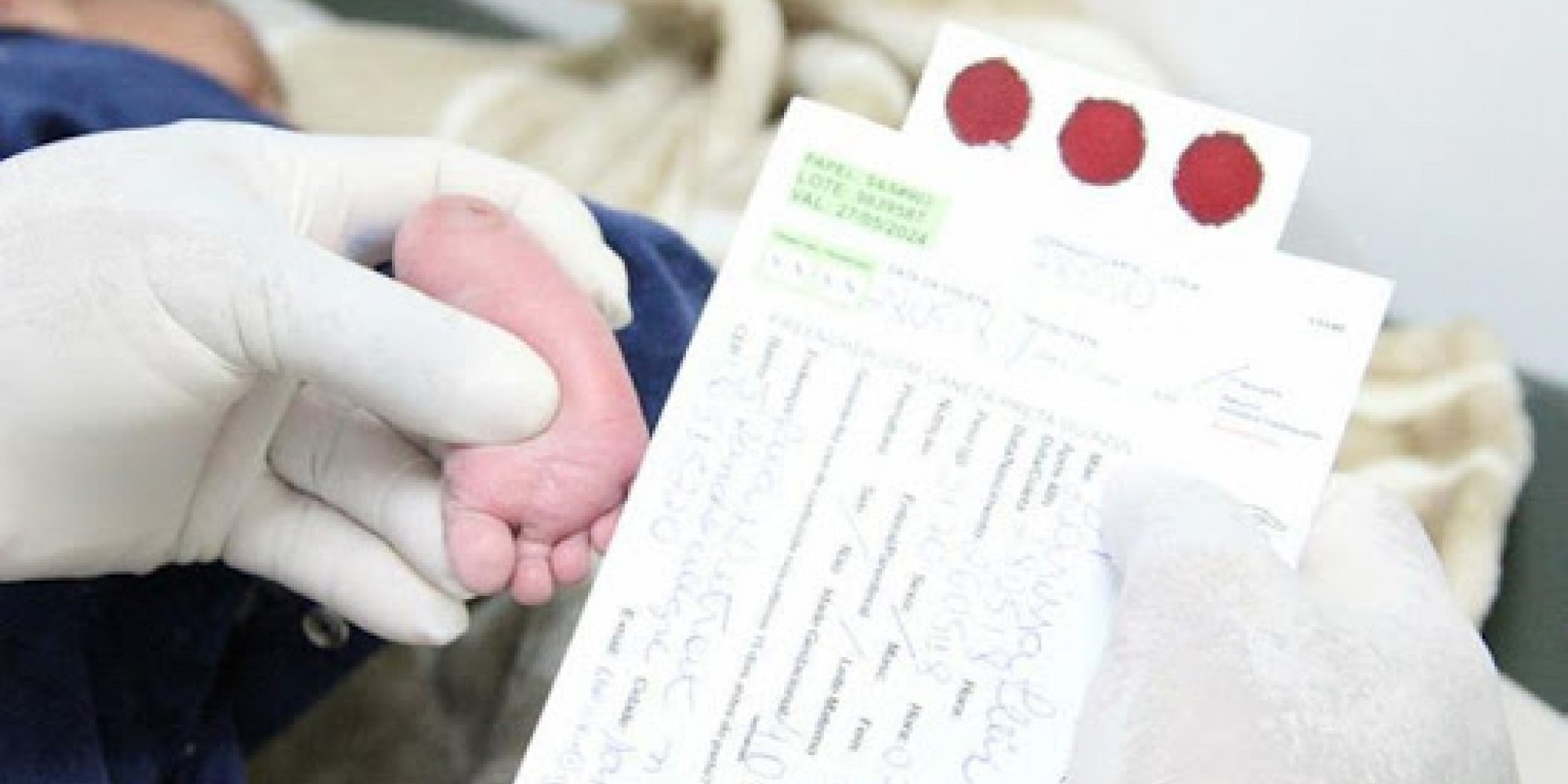 A partir deste ano, todos os recém-nascidos devem ser submetidos ao exame de toxoplasmose congênita SUS